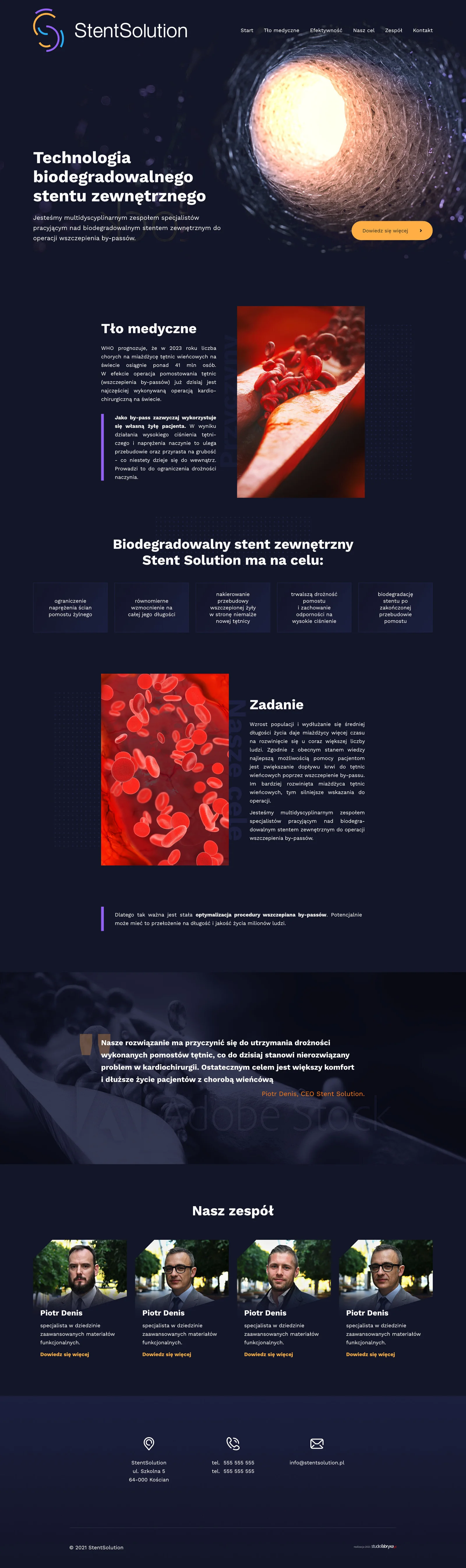 StentSolution